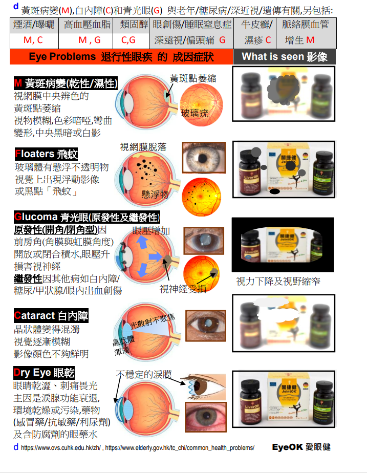 EyeOK 愛眼健
