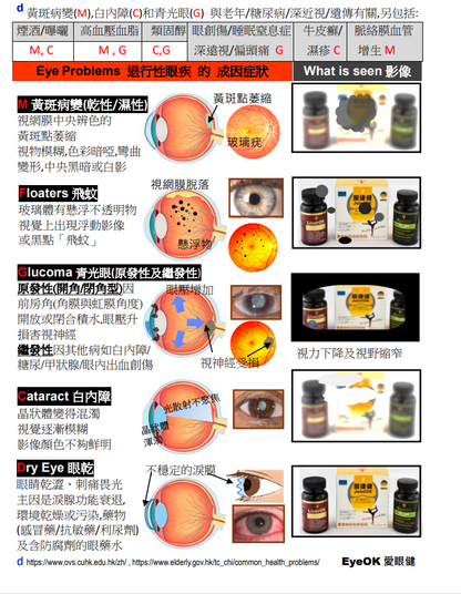 EyeOK 愛眼健